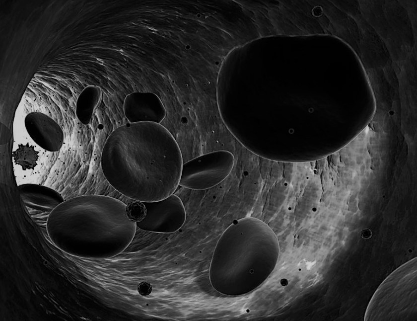 Grey Flattened platelets